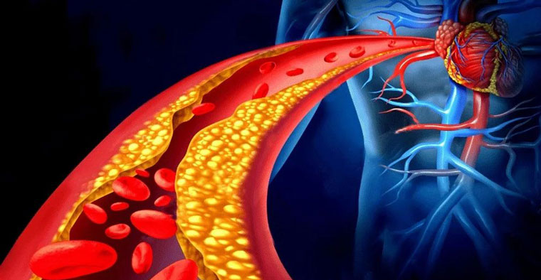 Pastiglie per la pressione arteriosa